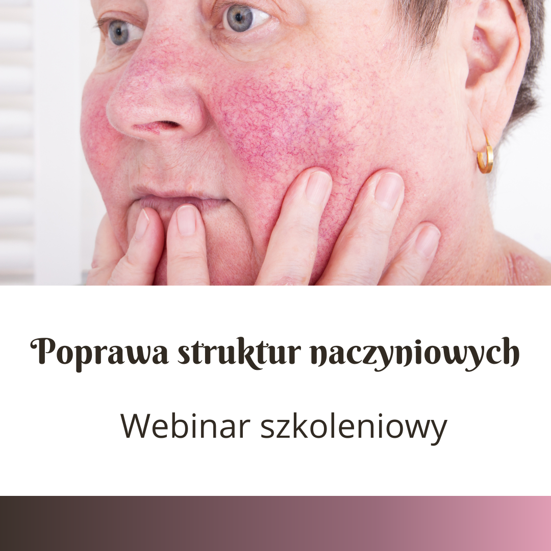 Poprawa struktur naczyniowych