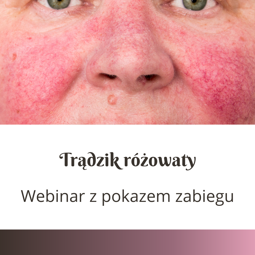 Webinar – Trądzik różowaty